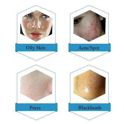 Facial Serum Clean Solution 50ml 3 Bottle/Set Solution For  Dermabrasion Skin Care Machine Care Salon Moisture Cleaner Machine