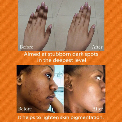 AILKE Dark Spot Corrector Cream, For Face & Body &Armpit,With Organic Arbutin,Intimate Whitening &Clear,Even Skin Tone skincare